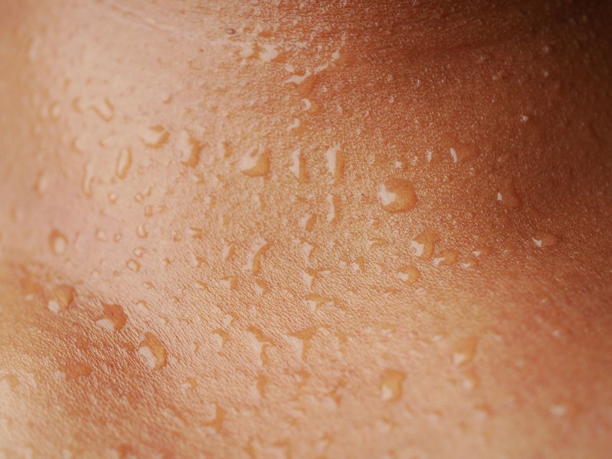 Segnali della menopausa